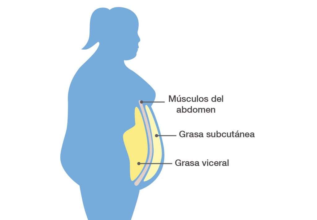 tipos de grasa abdominal