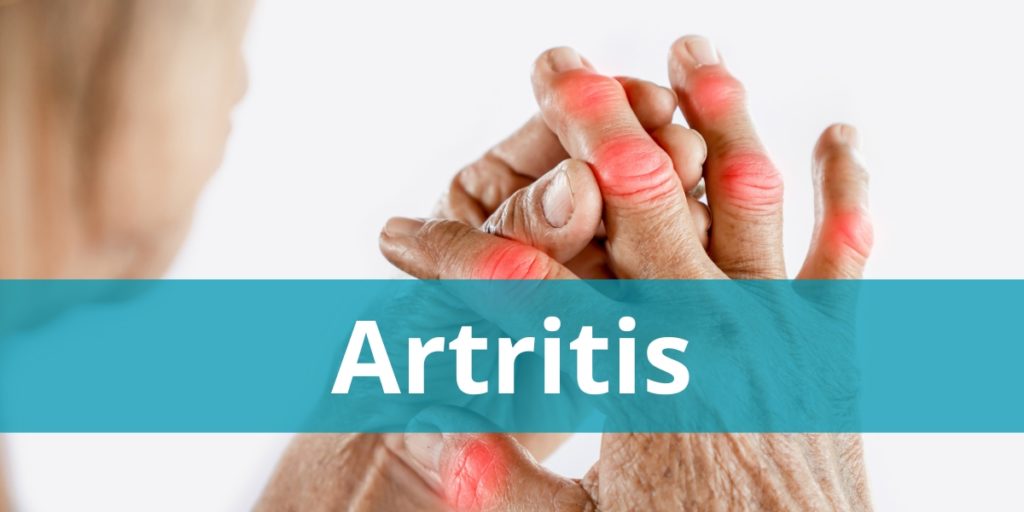 Artritis - Naturopata Online